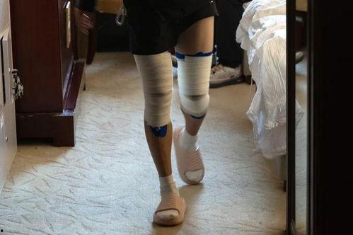 腿上缠绷带的图片,绷带见证的坚韧与希望
